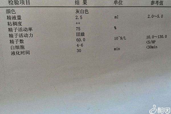 检查精子活力方法不少