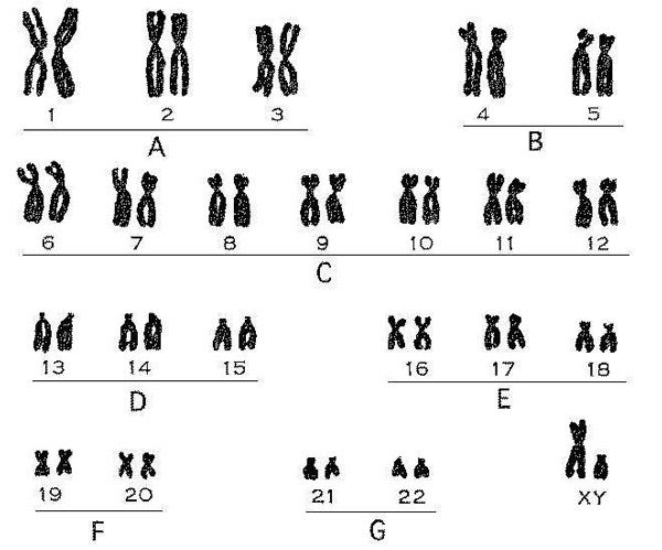 人类染色体核型分析