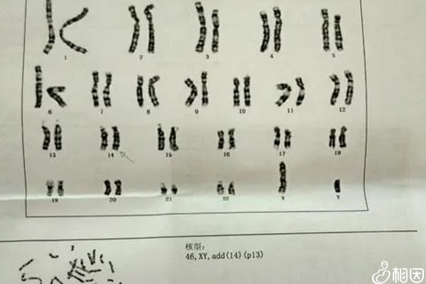 胚胎染色体检查出结果时间长