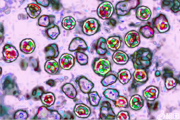 显微镜下的麻疹病毒