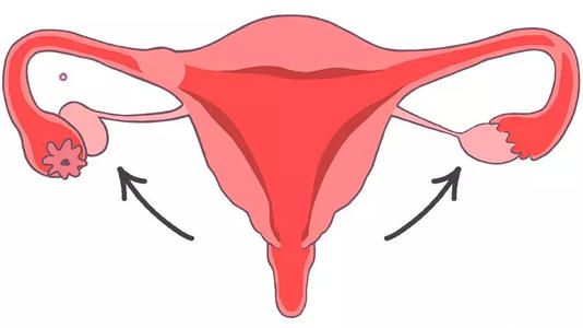 子宫内膜容受检查需要在月经后才能做
