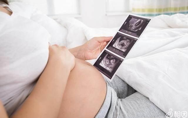 孕晚期b超检查内容