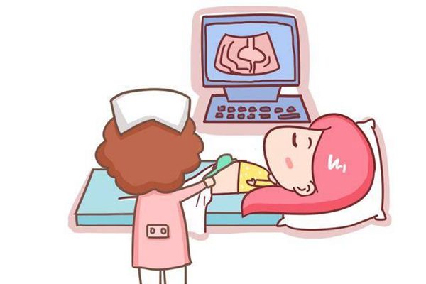临产前胎心监护